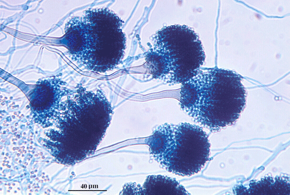 Bild: http://www.luminaryhealth.com/aspergillus_fumigatus.gif